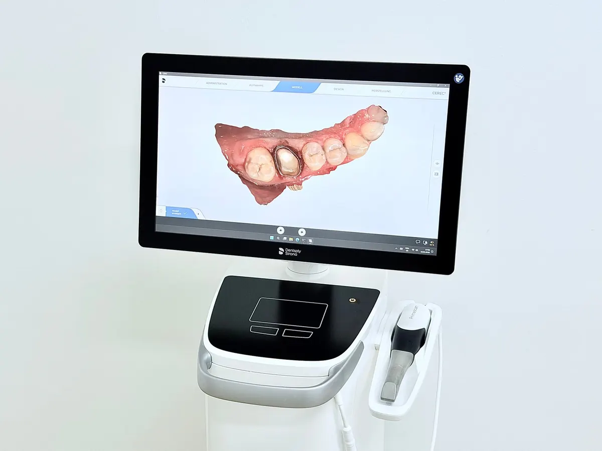 Digitaler 3D-Scan eines Zahnes